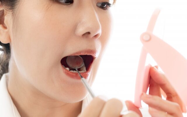 歯に小さい穴があるけど痛くない｜虫歯じゃないことも？原因と受診目安