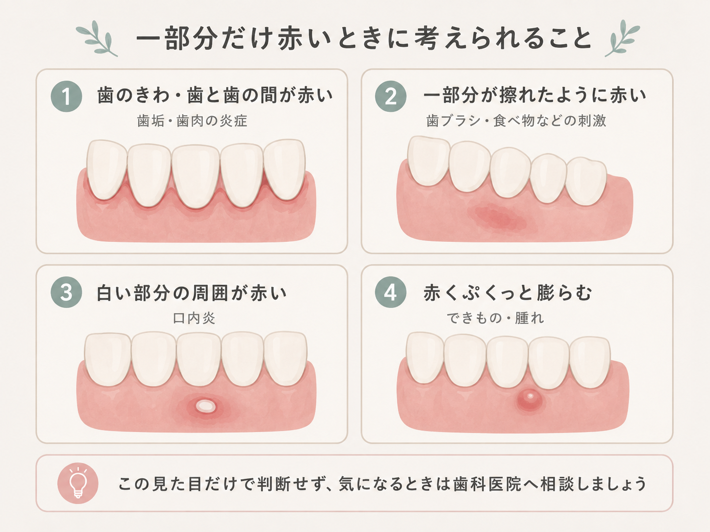 歯茎の一部分だけ赤い場合に確認したい場所と原因のイラスト