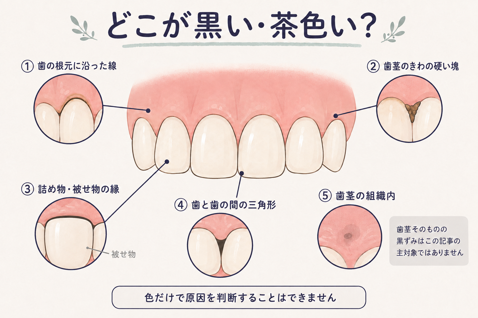 どこが黒い・茶色いかのイメージ図